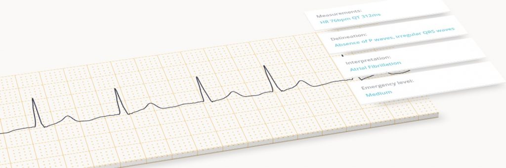 Logo de la startup Cardiologs recrute un/e  Data Scientist